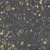 4T1-luc细胞敲除mGpaa1基因细胞系