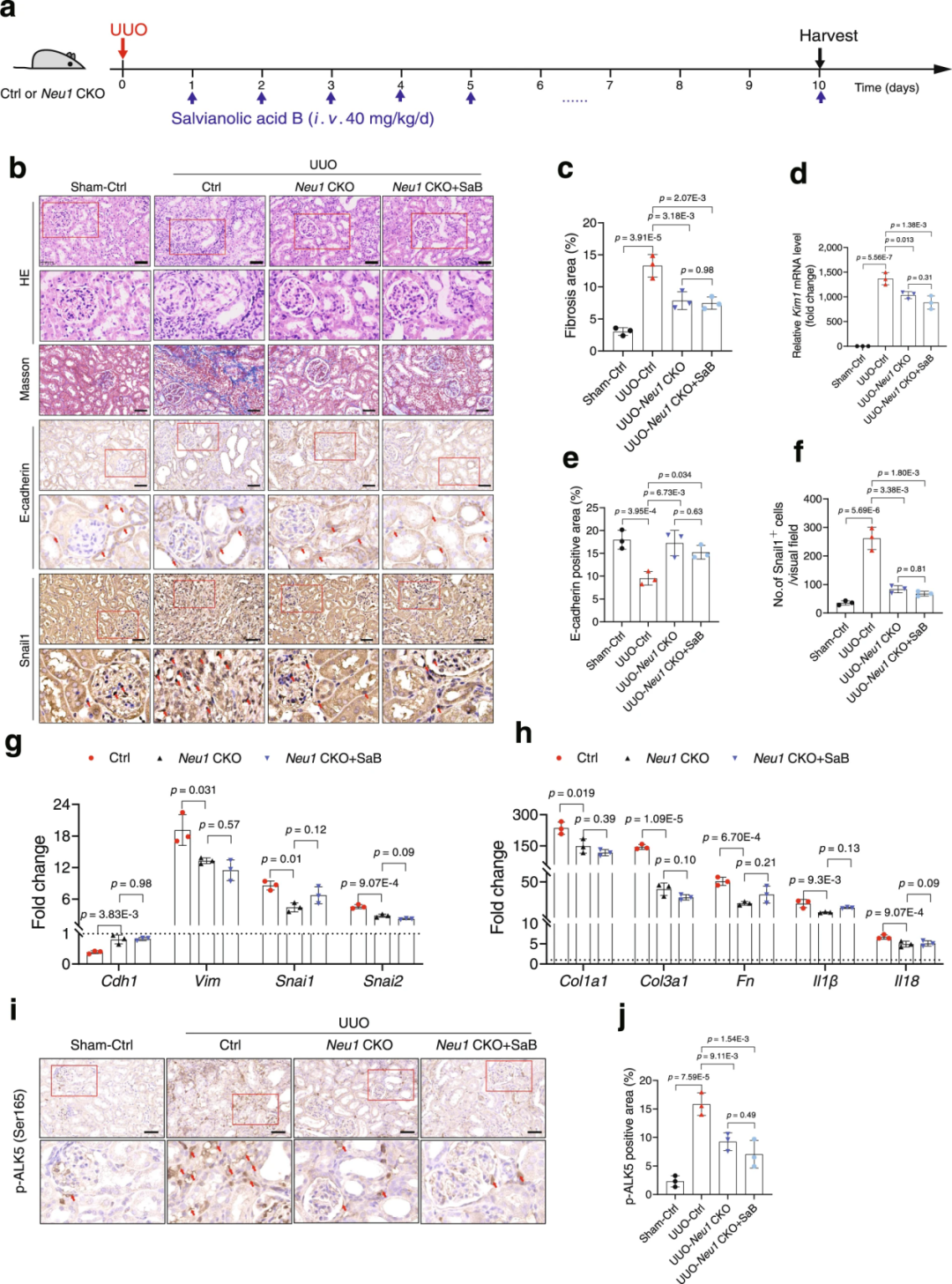 【AAV在肾脏疾病中的应用】IF=17.69│中国药科大学齐炼文教授/张蕾研究员团队揭示肾纤维化治疗新靶点及相关机制