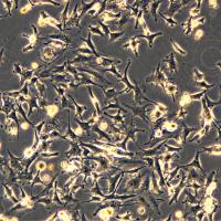 BT-549细胞敲除PDK1基因细胞系