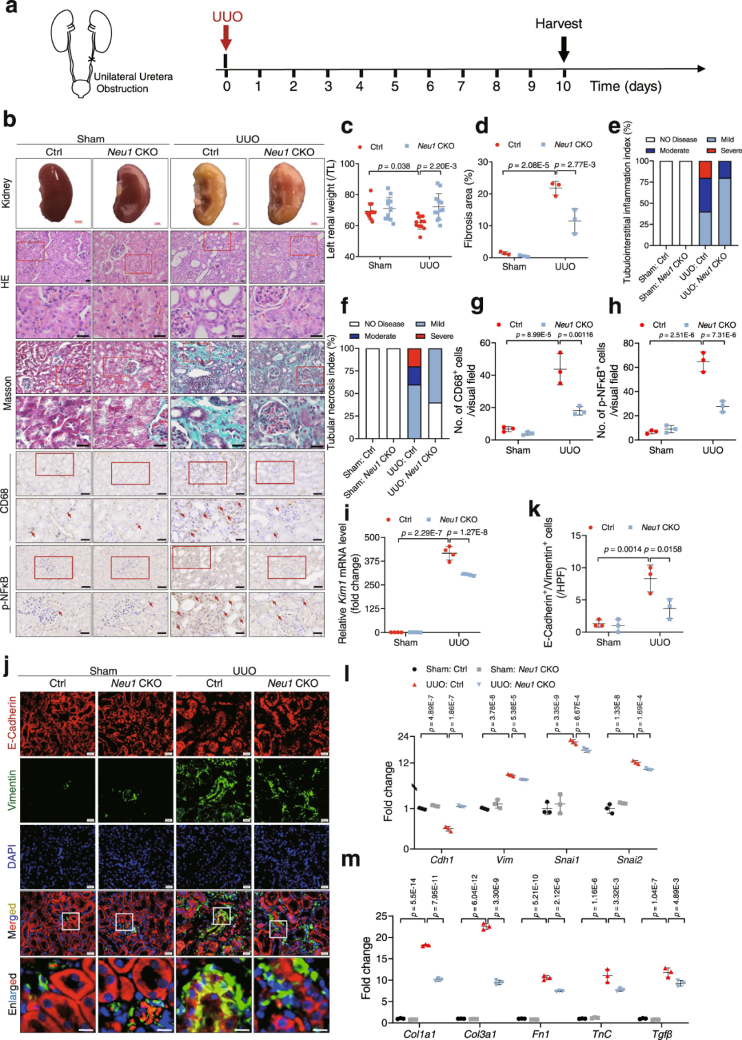 【AAV在肾脏疾病中的应用】IF=17.69│中国药科大学齐炼文教授/张蕾研究员团队揭示肾纤维化治疗新靶点及相关机制