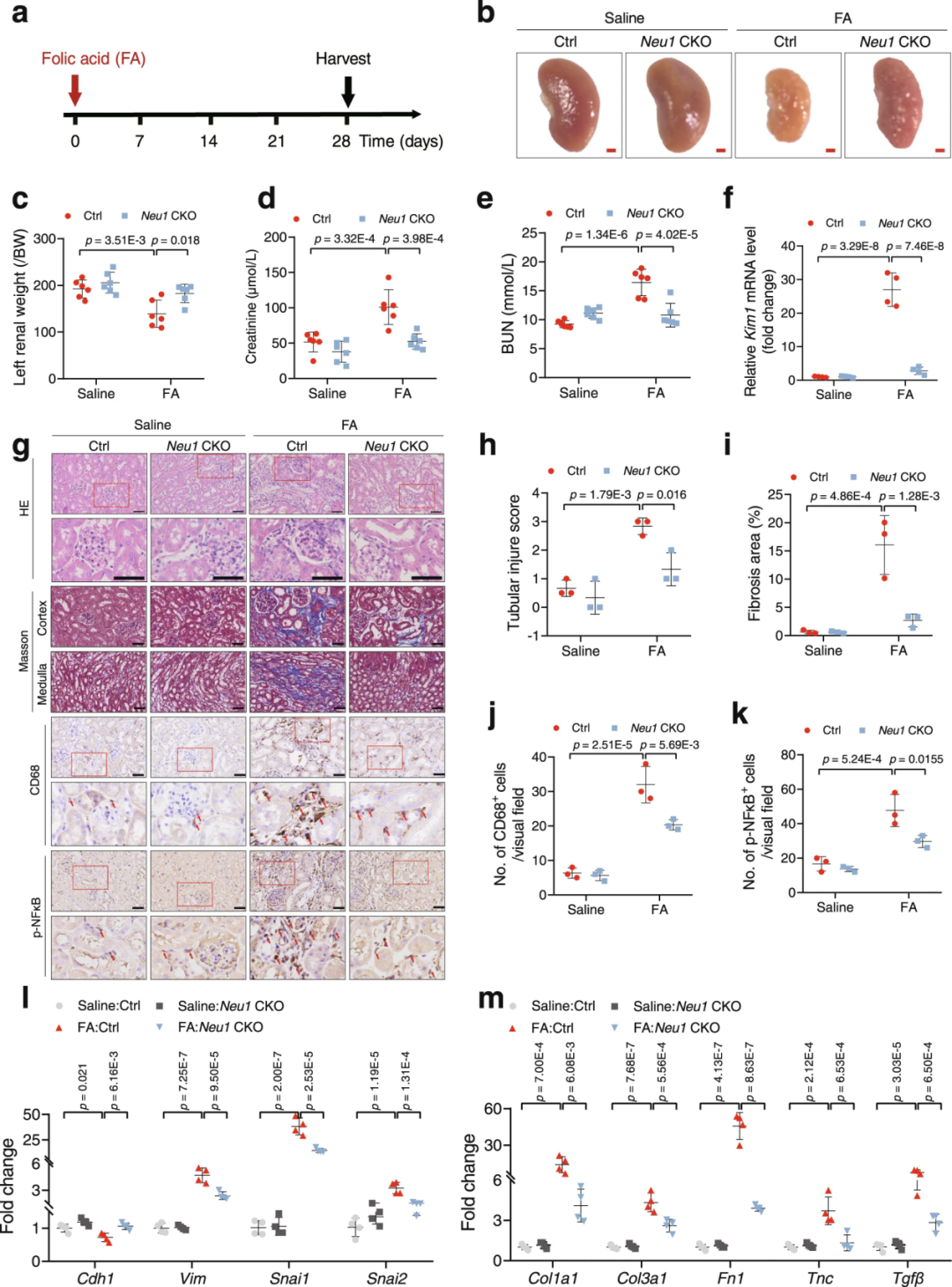 【AAV在肾脏疾病中的应用】IF=17.69│中国药科大学齐炼文教授/张蕾研究员团队揭示肾纤维化治疗新靶点及相关机制