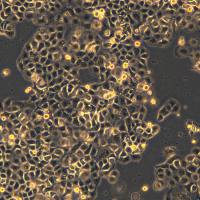 PANC-1细胞敲除hDTNBP1基因细胞系