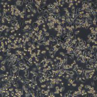 MC-38细胞敲除mPrmt3基因细胞系