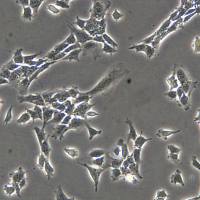 TM3细胞敲除mIgfbp5基因细胞株