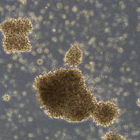 NK92细胞敲除ADORA2A基因细胞系