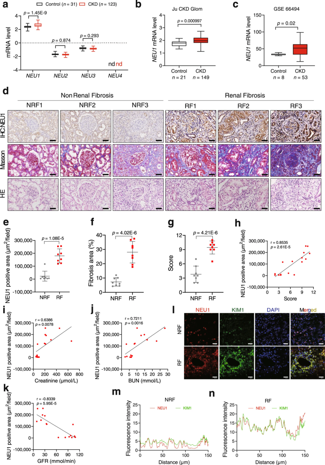 【AAV在肾脏疾病中的应用】IF=17.69│中国药科大学齐炼文教授/张蕾研究员团队揭示肾纤维化治疗新靶点及相关机制