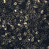 LX-2细胞敲除hNGLY1基因细胞系