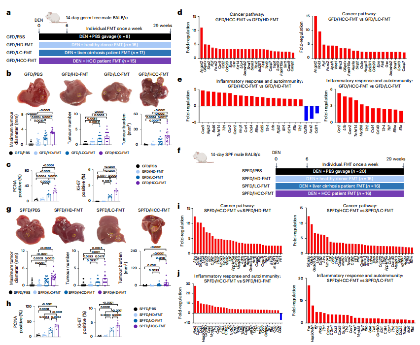 文献传递|肺炎克雷伯菌的肠-肝易位促进小鼠肝细胞癌