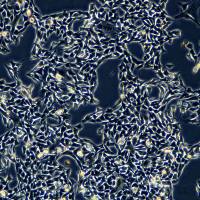 B16-F10细胞敲除mPrmt3基因细胞株