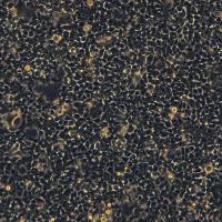 HEK293细胞敲除B2M基因细胞系