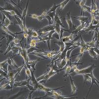 U-87MG细胞敲除hHNRNPA1基因细胞株