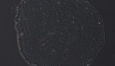 人多能干细胞的培养方法