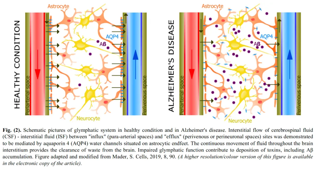 【AD创新治疗突破】颈深淋巴管－静脉吻合术：阿尔茨海默病患者的希望之路！