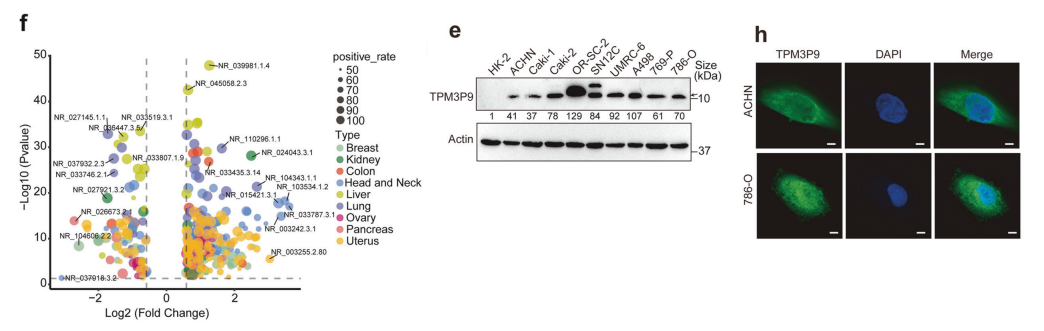 分子探针与表观遗传学研究好文分享：隐性lncrna编码的微蛋白TPM3P9驱动致癌RNA的剪接和肿瘤的发生