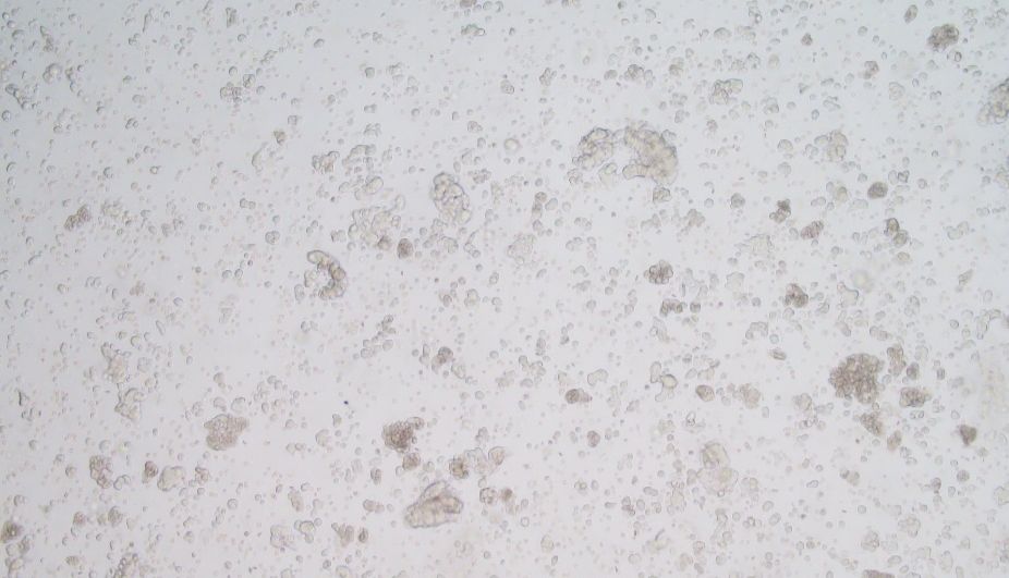 人神经干细胞培养方法及诱导形成脑类器官