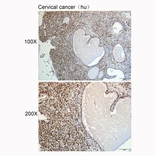 抗体产品星推荐第二十五期|Anti-HMGB1 Polyclonal Antibody