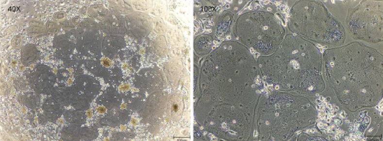 重组人MC1R蛋白(N-His)
