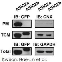 Plasma膜蛋白Extraction试剂盒(ab65400)(Abcam ab65400 现货