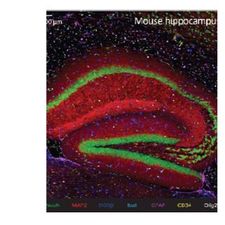 神经退行性疾病成像 PANEL,试剂盒