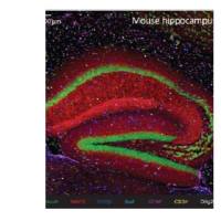 神经退行性疾病成像 PANEL，试剂盒