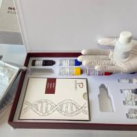 枪状肝吸虫探针法荧光定量PCR试剂盒