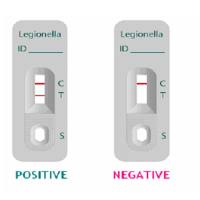 军团菌尿抗原抗体快速检测试剂盒（日本荣研））