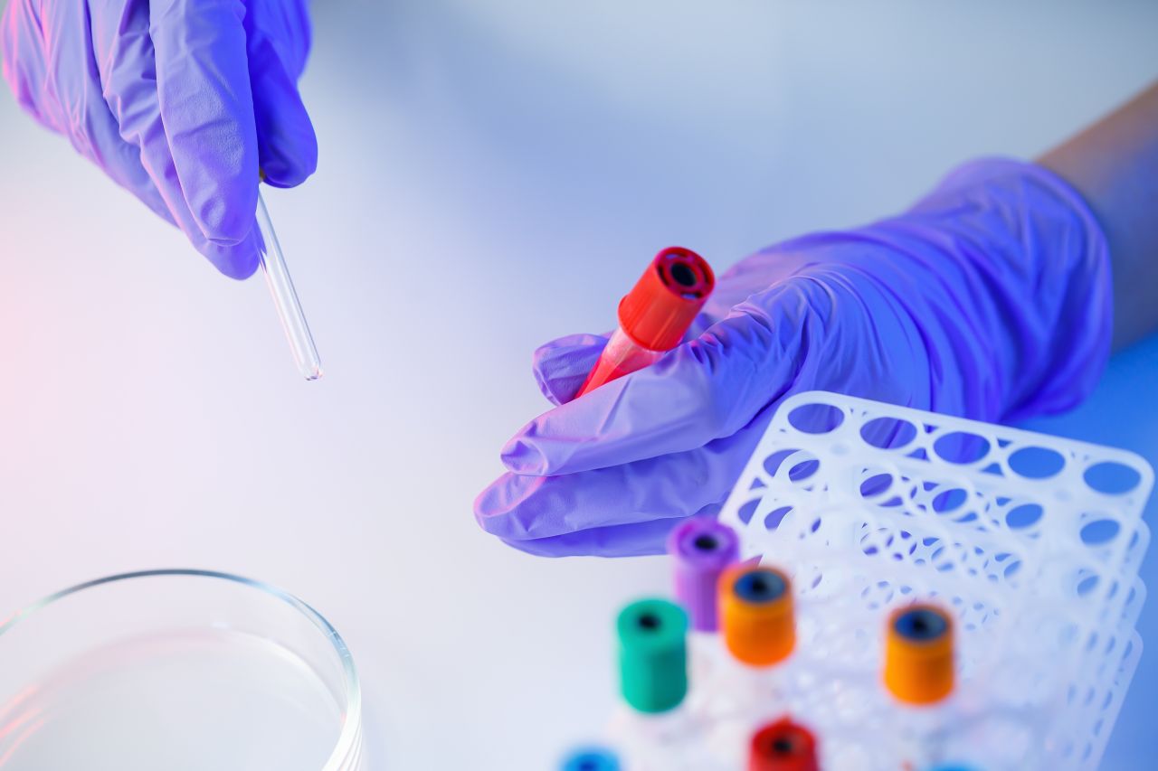 肾上腺.素/去甲肾上腺.素/多巴胺三联检测试剂盒（酶联免疫法