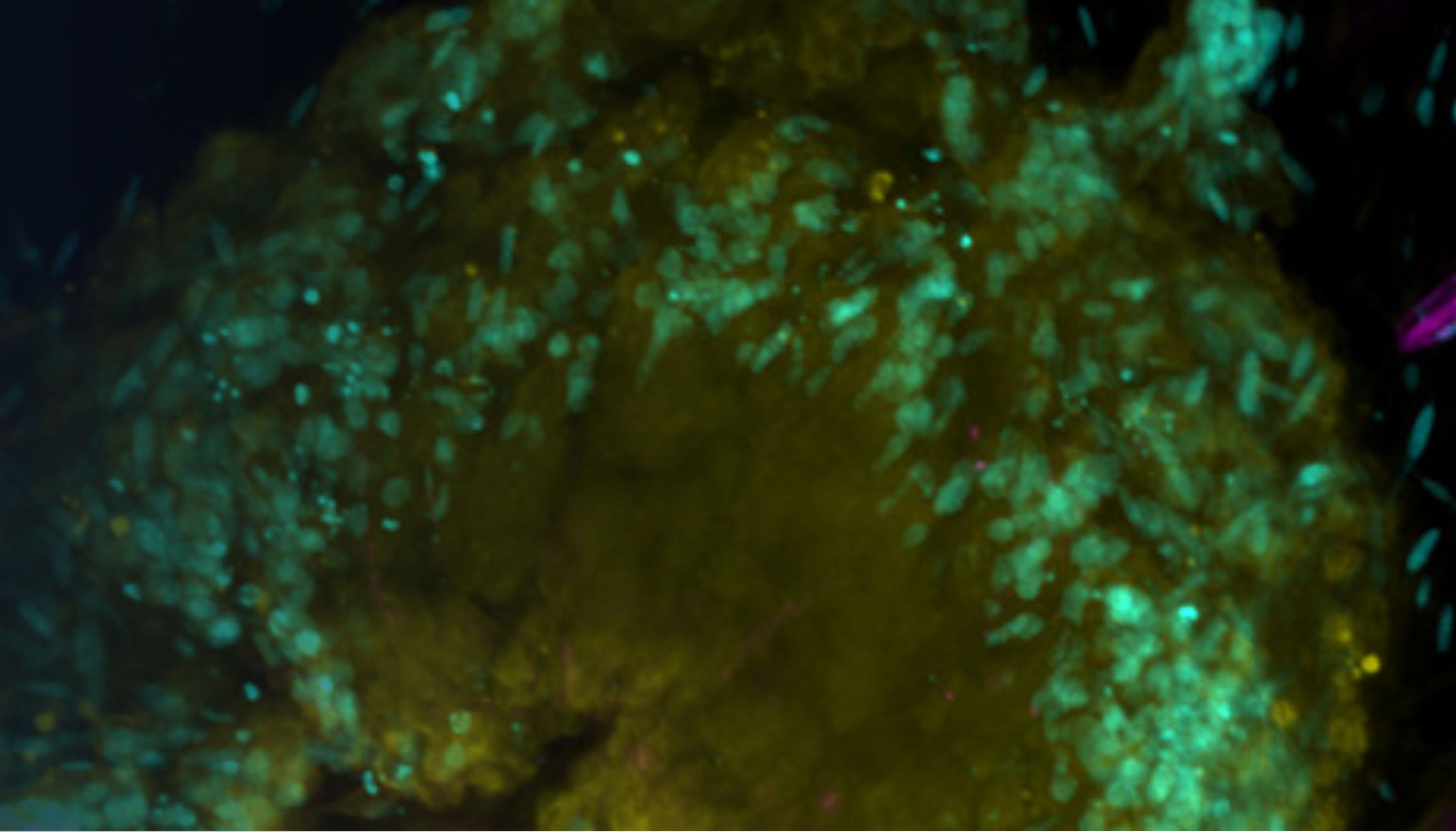 使用EVIDENT共聚焦显微镜对血管化肿瘤细胞球芯片进行观察研究