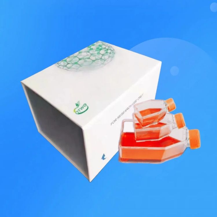 TEC人胸腺上皮细胞|永生化、人胸腺上皮细胞系|TEC细胞|TECs