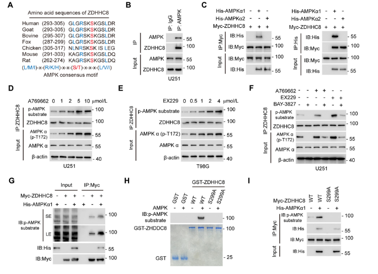 image.png “棕榈酰化”与“铁死亡”强强联手,让胶质瘤“死个明白”!