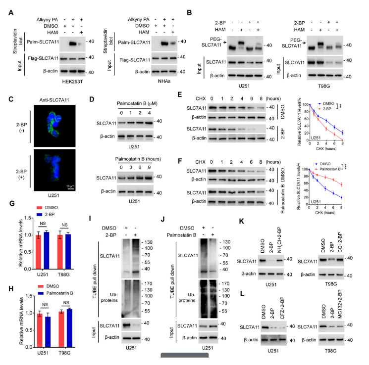 image.png “棕榈酰化”与“铁死亡”强强联手,让胶质瘤“死个明白”!