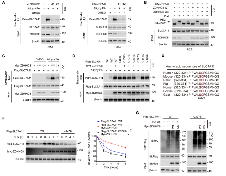 image.png “棕榈酰化”与“铁死亡”强强联手,让胶质瘤“死个明白”!