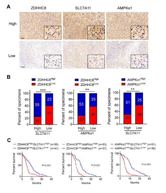 image.png “棕榈酰化”与“铁死亡”强强联手,让胶质瘤“死个明白”!