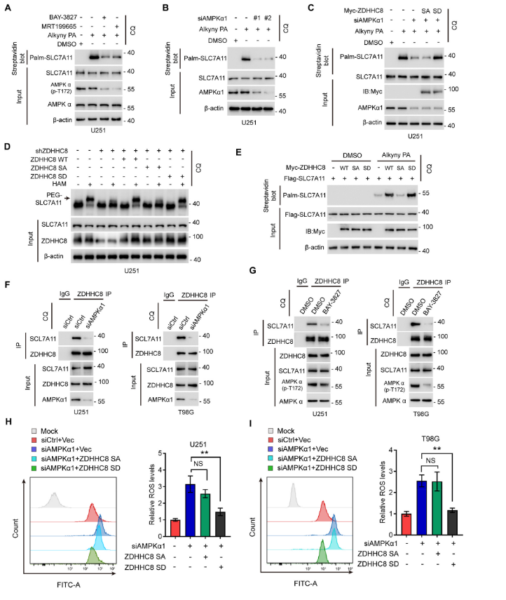 image.png “棕榈酰化”与“铁死亡”强强联手,让胶质瘤“死个明白”!
