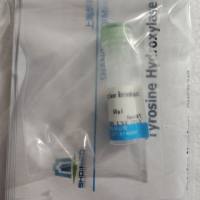 离子化钙结合适配分子1(IBA1)重组蛋白,人