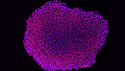 IPS诱导肠类器官培养攻略（第一阶段）
