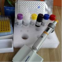 猴腺苷酸环化酶1(ADCY1)酶联免疫ELISA试剂盒