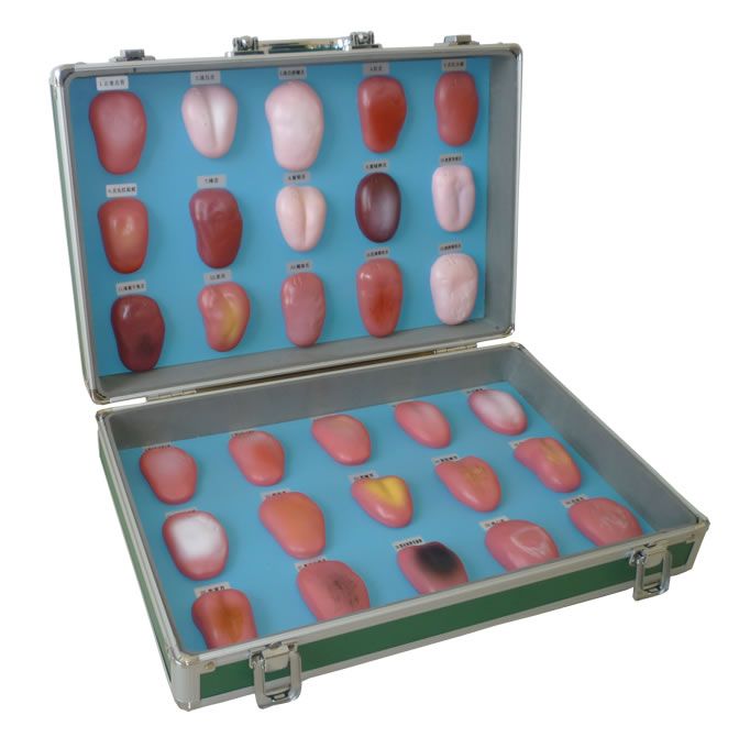 舌苔模型 中医正常舌苔及各种疾病在舌苔模型