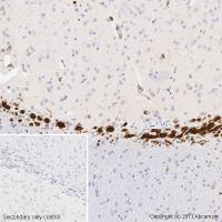 重组Anti-Doublecortin抗体[EPR19997] (ab207175) 现货特卖