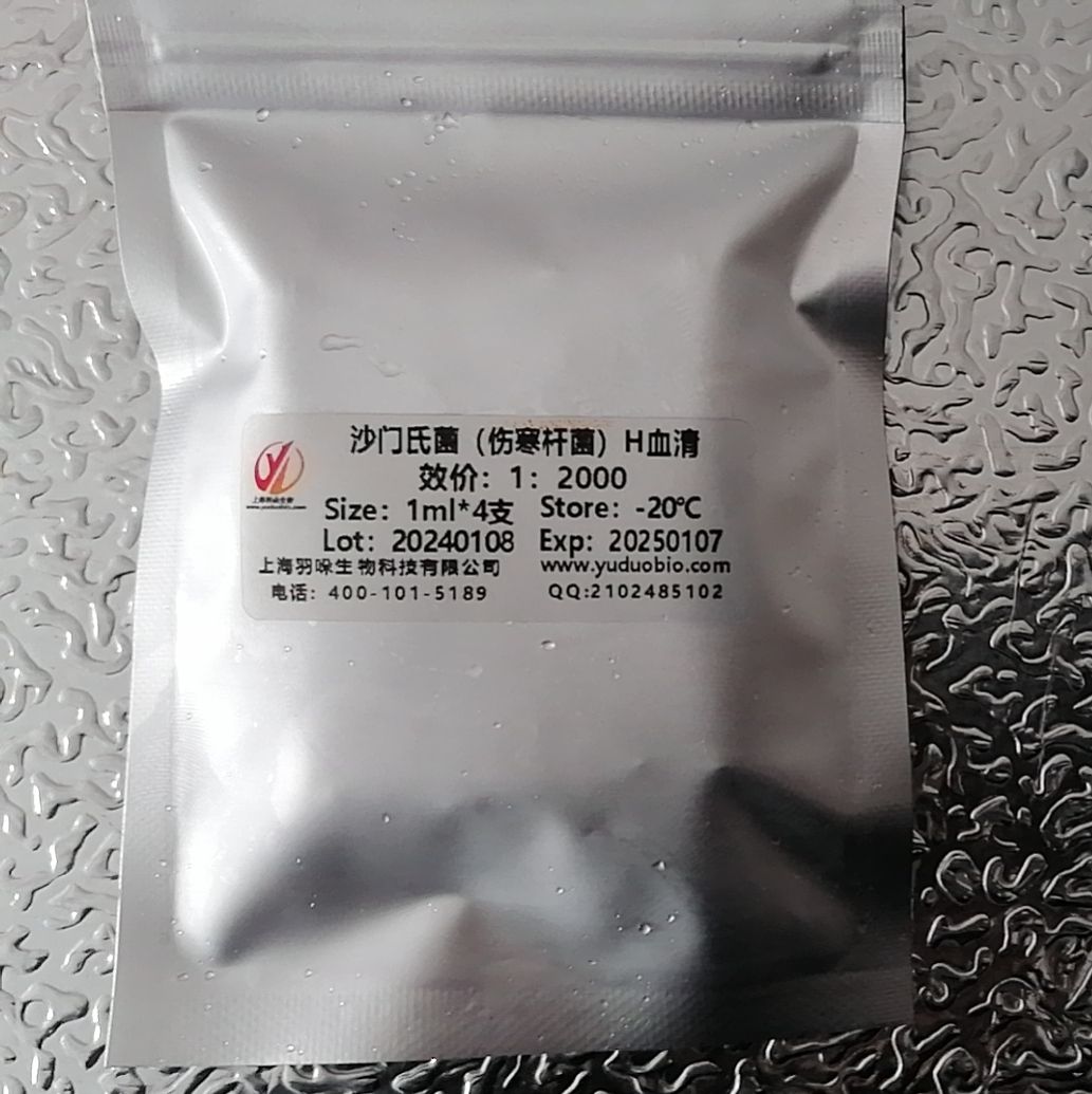 兔抗伤寒杆菌0(或H)血清抗体