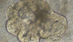 IPS诱导肠类器官培养攻略（第三阶段）