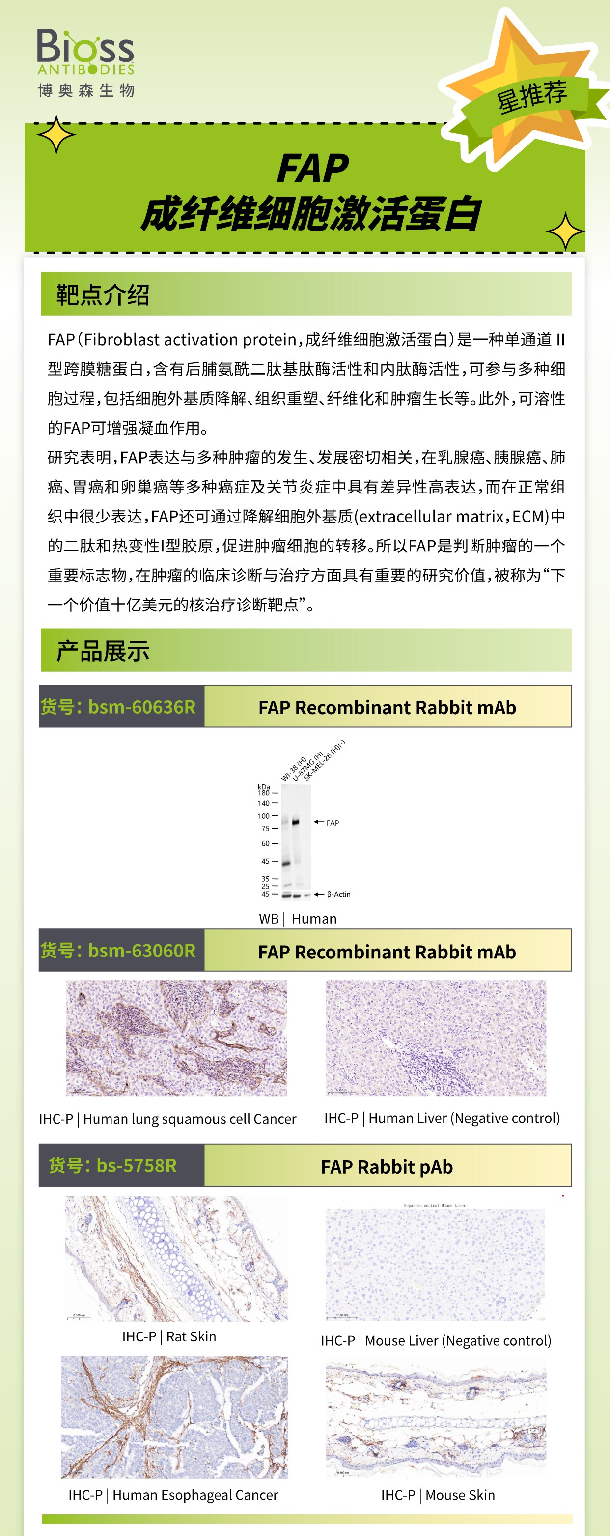 Bioss 星推荐 | FAP-成纤维细胞激活蛋白
