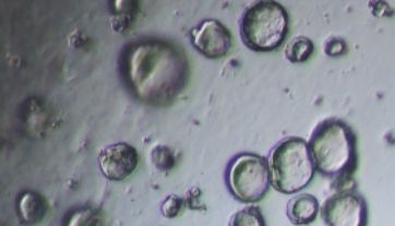 IPS诱导肠类器官培养攻略（第二阶段）