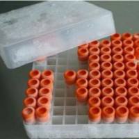 粪便RNA样本保存管