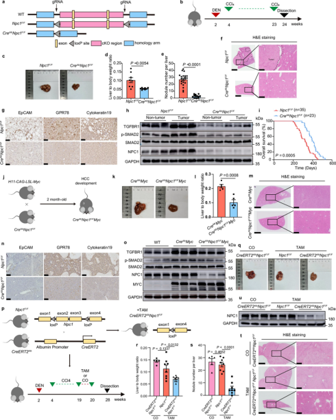 Nat Commu丨国家蛋白质科学中心姜颖/贺福初团队揭示NPC1在肝细胞癌中的作用