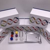 猴胎儿血红蛋白(HBF)酶联免疫ELISA试剂盒