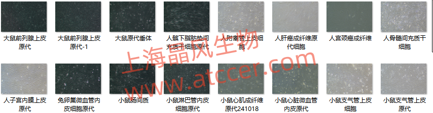 ATCC来源人气管平滑肌细胞HTSMC