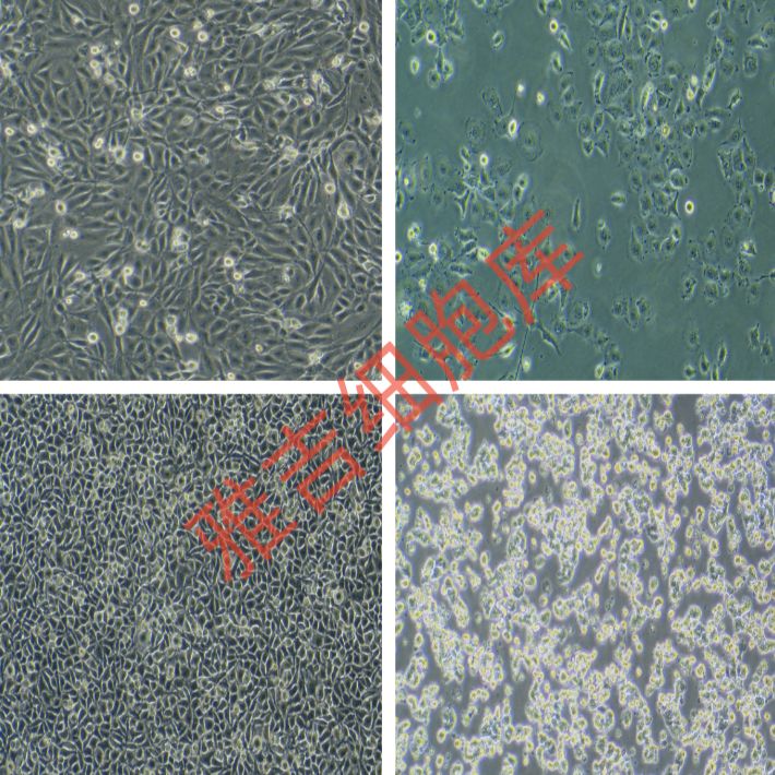 ATCC来源人宫颈癌细胞HeLa229