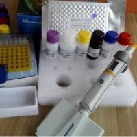 兔胞浆磷蛋白1(STMN1)酶联免疫ELISA试剂盒