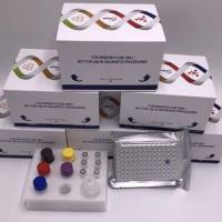 猴鞘磷脂(SM/SPH)酶联免疫ELISA试剂盒